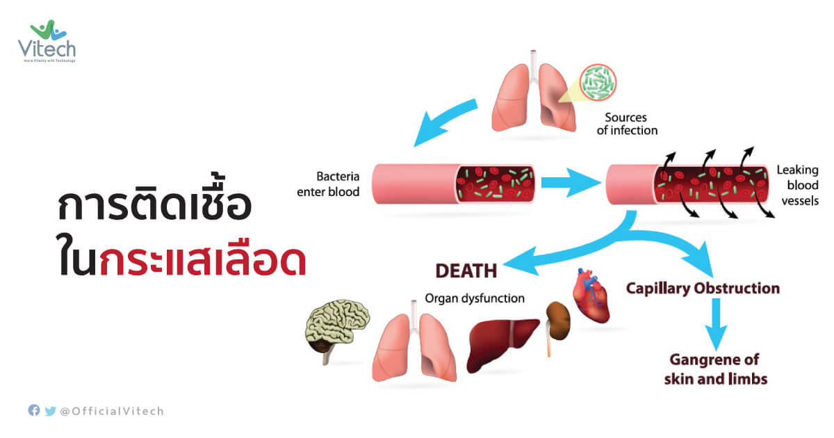 ไข้หูดับ-กับการติดเชื้อในกระแสเลือด