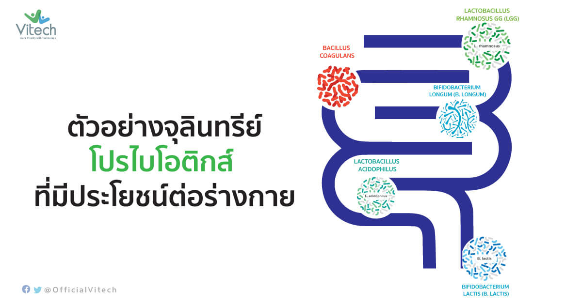 ตัวอย่างจุลินทรีย์โปรไบโอติกส์-ที่มีประโยชน์ต่อร่างกาย